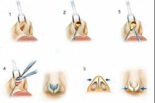 2023常德哪里可以做到去額頭紋的皮秒整形美容醫(yī)院排行榜前10強(qiáng)露面！