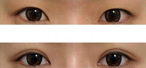 佛山口周紋有哪些醫(yī)院可以進行活細胞治療？2023排名前10的專業(yè)機構精選！