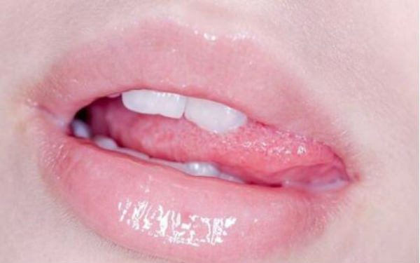 深圳眼角靜態(tài)紋醫(yī)生