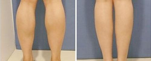 鄭州這家醫(yī)療整形院治療痘坑效果不錯(cuò)，值得推薦！2023最新排名TOP10出爐！