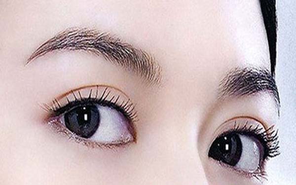 鄭州眶隔釋放去眼袋醫(yī)生