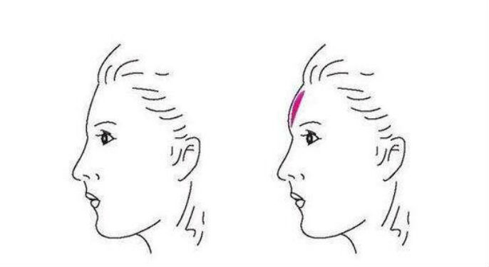 2023年安康市排名前10的專業(yè)整容醫(yī)院，注射自體脂肪顆粒豐顳術(shù)技術(shù)好！