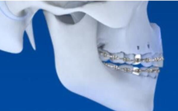 2023北京市面部整形醫(yī)院精心推薦，挑選您滿(mǎn)意的五官整形機(jī)構(gòu)！