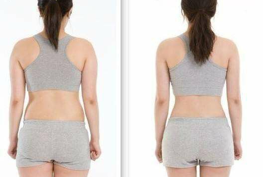 沈陽(yáng)激光點(diǎn)陣祛斑首選，10家性價(jià)比比較高的醫(yī)院2023全新推薦！