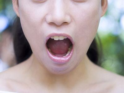 常德線雕收緊下顎醫(yī)生