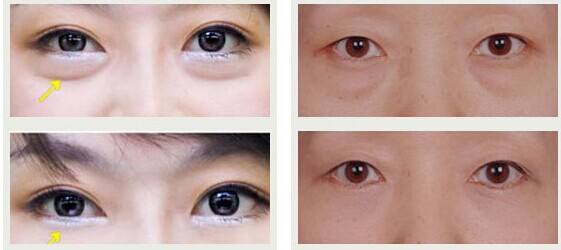 東莞有哪些效果好的川字紋除皺醫(yī)院？2023年東莞十大正規(guī)醫(yī)院排行榜出爐！