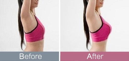 揭秘2023深圳治療抬頭紋熱門醫(yī)院排行榜top10！這些明星醫(yī)院廣受推崇，種草不斷！