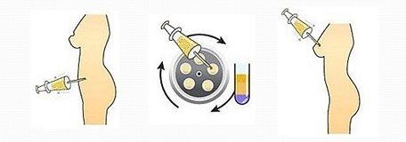 上海哪家整形醫(yī)院治療生長紋比較好？2023最可靠的前十強醫(yī)院有哪些？
