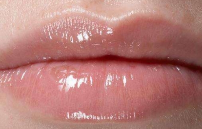 蘭州比較靠譜的去口周紋整形醫(yī)院是哪家？2023年蘭州去除口角紋綜合排名揭曉，這幾家口周紋醫(yī)療整形醫(yī)院實(shí)力