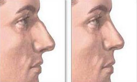 2023年合肥治療筒狀乳房畸形首選的專業(yè)整形醫(yī)院排行榜TOP10強(qiáng)推薦！