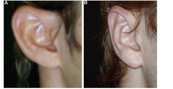 鄭州治療老年斑有口碑的整形醫(yī)院推薦！附2023年鄭州消除老年斑前十強(qiáng)排行！