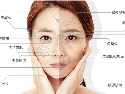 廣州臉部打溶脂針排名前10的美容醫(yī)院口碑大揭秘！2023年很受好評的整形醫(yī)院技術(shù)盤點！