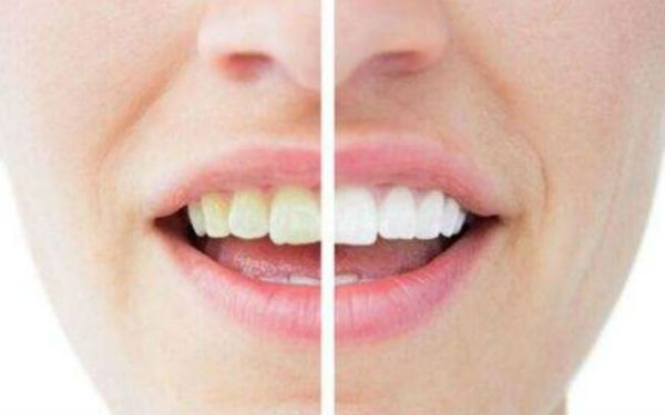 深圳豐太陽(yáng)穴整形醫(yī)院口碑非好好！2023年十佳面部注射豐太陽(yáng)穴醫(yī)院排名出爐