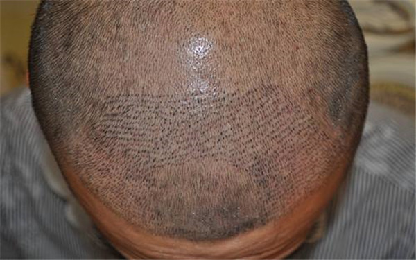 銀川口附近的10家高性價(jià)比周紋射頻去除醫(yī)院，了解一下！