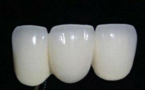 徐州豐太陽穴整形醫(yī)院推薦！2023非常受歡迎的膨體填豐太陽穴醫(yī)療機構(gòu)介紹！