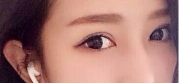 2023年山東哪些醫(yī)療美容醫(yī)院推薦度高，專業(yè)祛除眼周紋的前十家？