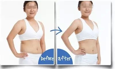 成都抽脂隆胸整形醫(yī)生