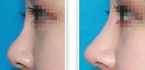 2023寧波頭部皺紋祛除醫(yī)院口碑排行榜top10公開總結(jié)！