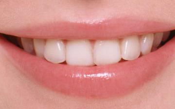 河源眼部皺紋消除醫(yī)生