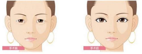 2023年哪些北京血小板除皺醫(yī)院備受推崇？這幾家醫(yī)院排行前十，別錯過！