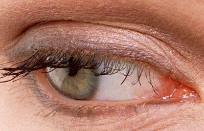 2023年口碑爆棚！蘇州肉毒素整形美容醫(yī)院排名前10，暢銷！