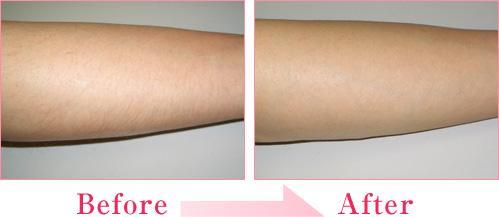 2023年佛山乳房切除醫(yī)院十佳口碑排行榜出爐，權(quán)威醫(yī)院值得信賴！