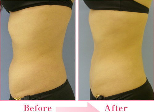 2023年，桂林哪家醫(yī)療整形醫(yī)院排名前十的專業(yè)眼紋去除法整形醫(yī)院