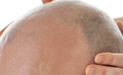 寧波市有哪些口碑比較好的整形美容醫(yī)院？2023年推薦的綜合鼻整形前十名！