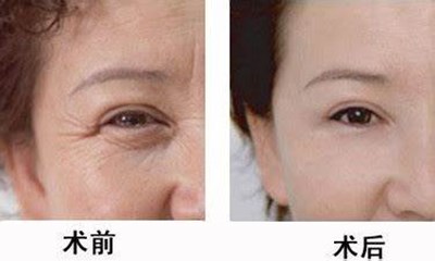 2023年惠州治療木偶紋的十家整形醫(yī)院推薦