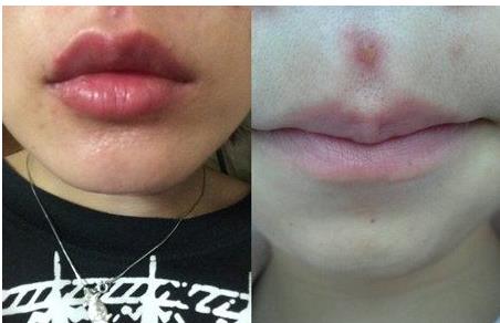 2023青島哪些醫(yī)院口碑好，提供專業(yè)的提拉魚尾紋醫(yī)療美容服務(wù)？青島魚尾紋醫(yī)院TOP10強(qiáng)機(jī)構(gòu)推薦