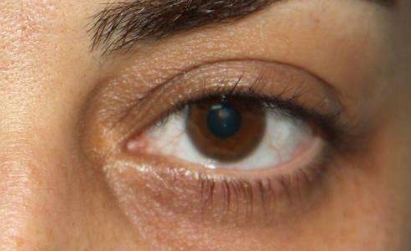 唐山哪家專業(yè)整形醫(yī)院在韓式微創(chuàng)雙眼皮恢復方面經(jīng)驗豐富？2023年唐山醫(yī)療整形院雙眼皮恢復排名前十可信賴嗎