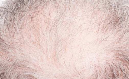 2023成都領(lǐng)先的隱私光電抗衰整容醫(yī)院排名前10公布！