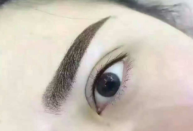 鄭州眉間紋淡化，2023年十大整形美容醫(yī)院推薦