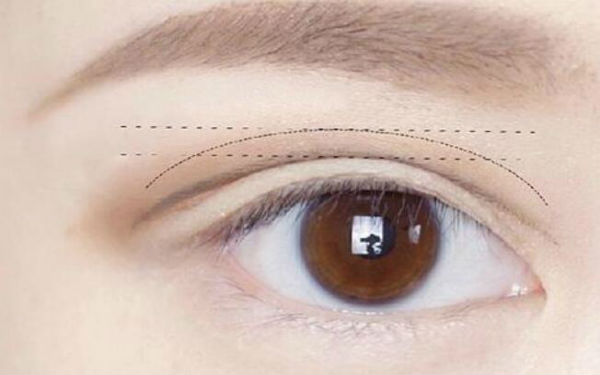 2023西安黃褐斑祛除醫(yī)院排行榜出爐！這十所醫(yī)療整形醫(yī)院備受好評(píng)！