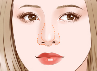 湖州超聲波去眼袋整形美容醫(yī)院排名揭曉！2023年比較推崇的湖州去眼袋醫(yī)院前十強(qiáng)+綜合口碑