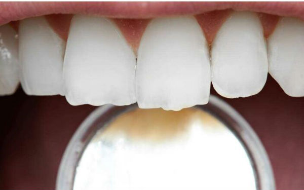 2023年哪家醫(yī)院在鎮(zhèn)江做水動力抽脂瘦腰效果比較好？TOP10整形醫(yī)院發(fā)布！