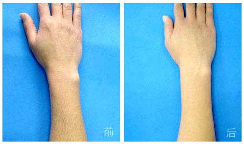 杭州哪家整形美容醫(yī)院能有效避免眼部皺紋？2023年杭州眼部皺紋美容醫(yī)院前十位排行榜來啦！