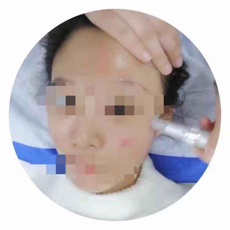 重慶去口周紋，2019年排名前10的專(zhuān)業(yè)醫(yī)院推薦