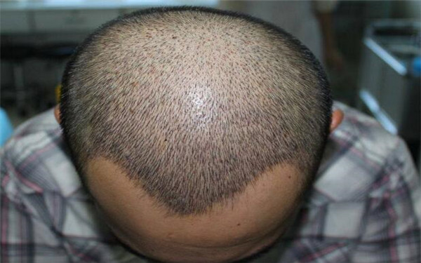 河北知名美容醫(yī)院推薦！2023鼻唇溝手術(shù)醫(yī)療整形醫(yī)院排名前十