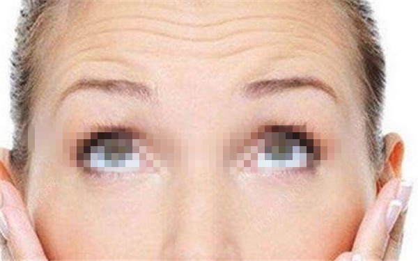 西安治療面部皺紋的著名醫(yī)院推薦！2023年排名前十，絕對(duì)值得考慮！