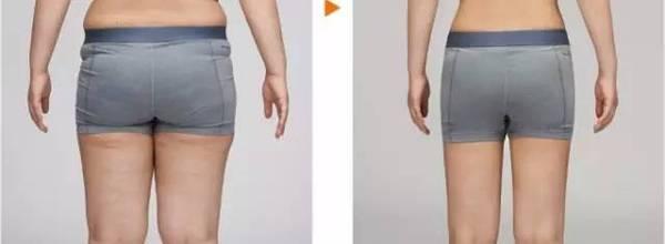 2023年北京妊娠紋整形美容機構(gòu)排名前10，哪家權(quán)威可靠？