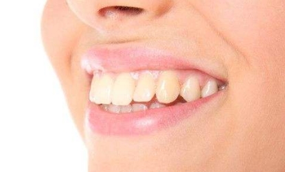 2023杭州口周紋整形醫(yī)院口碑好的有哪些？杭州物理去口周紋醫(yī)院排名揭曉！