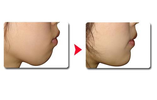 2023年贛州推薦的高度贊譽的面部皺紋微整醫(yī)療美容醫(yī)院排行榜前10