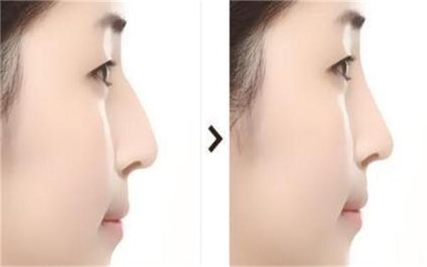 2023年中回顧！阜陽注射祛疤痕領(lǐng)域權(quán)威整形美容醫(yī)院排行榜TOP10強(qiáng)揭曉！