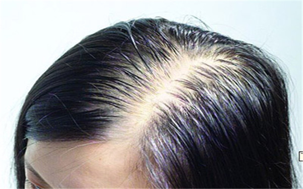 2023年莆田除皺醫(yī)院排行榜前十強(qiáng)，這些醫(yī)院的口碑如何？