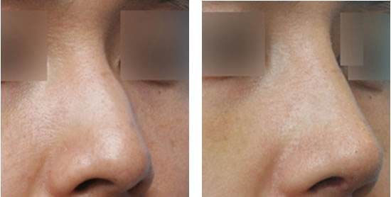 長(zhǎng)沙法令紋填充，2023年10家美容醫(yī)院排名榜單發(fā)布