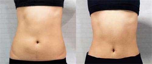 非常受歡迎的眼鼻部微創(chuàng)整形醫(yī)院推薦-2023年深圳前10名更新！