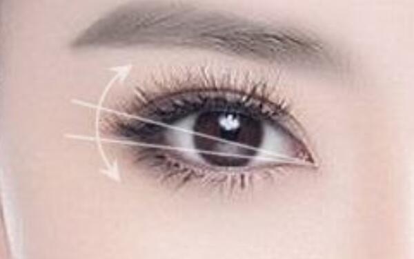 上海哪家醫(yī)院提供專業(yè)光纖溶脂祛魚尾紋服務？2023最新排名揭曉！