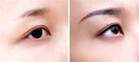 廣州吸脂瘦大臂整形醫(yī)院盤點！2023年強(qiáng)力推薦前10家！