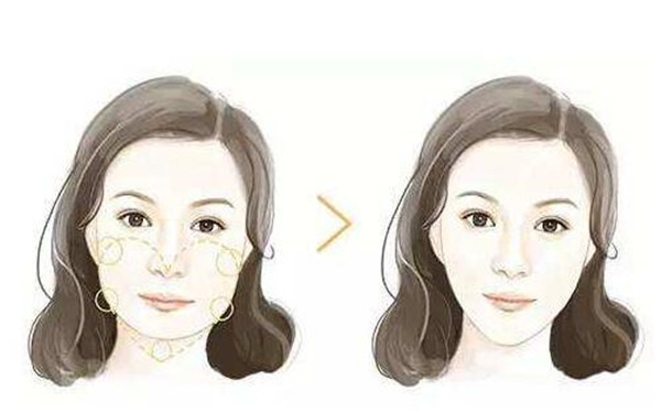 南京哪家整形醫(yī)院能有效去除面部皺紋？2023年南京治療面部皺紋醫(yī)院排名前10強(qiáng)！